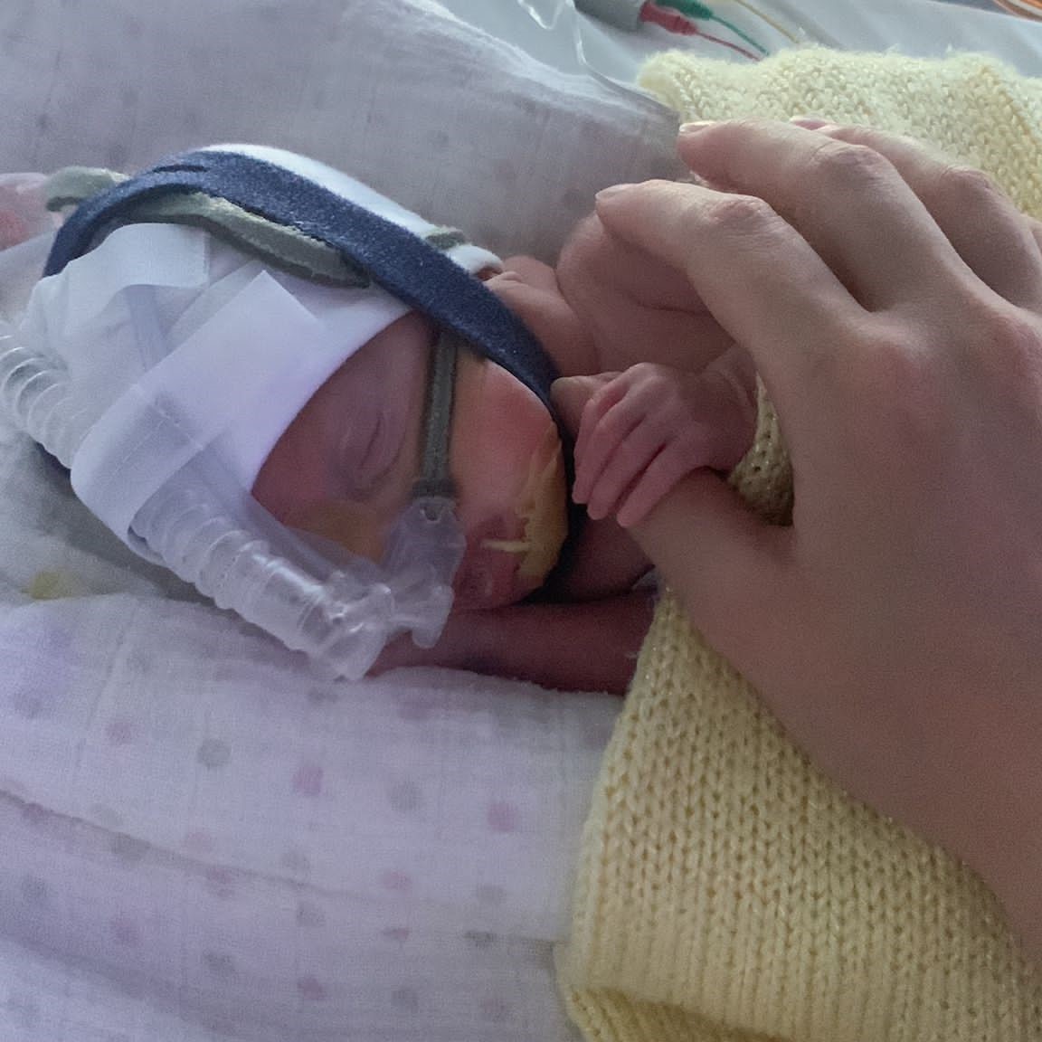 A premature baby in NICU. She has breathing support and tubes and is holding her father's hand as she sleeps