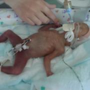 Baby Mason in incubator.